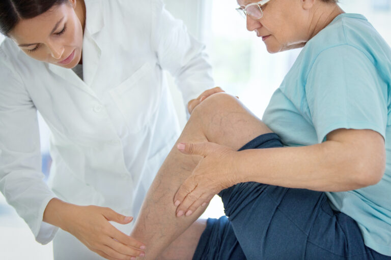 Cellulitis Tips for Care and Prevention
