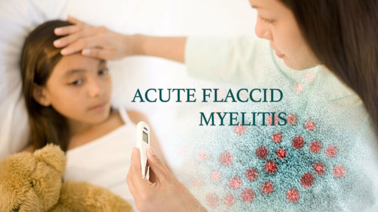 Acute Flaccid Myelitis: Causes and Symptoms