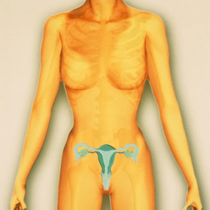 The MRKH syndrome: The absence of Vagina and Uterus