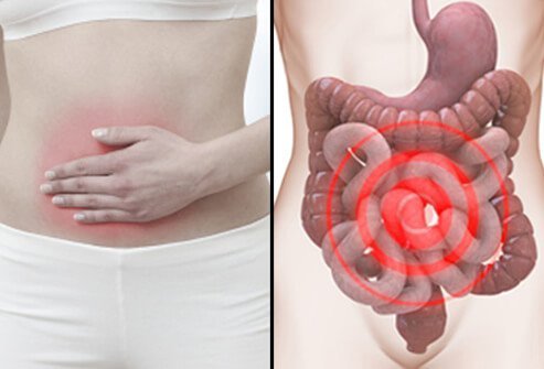 Abdominal Pain, What’s Causing It and Treatment