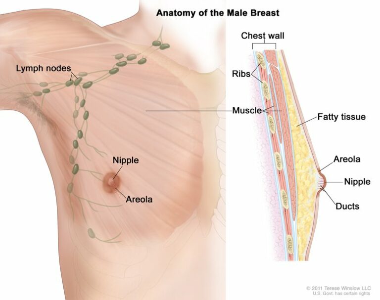 Male Breast Cancer: Symptom, And Causes