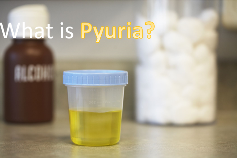 Pyuria: Symptoms, Causes, and Treatment
